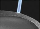 laser en trasplante de cornea